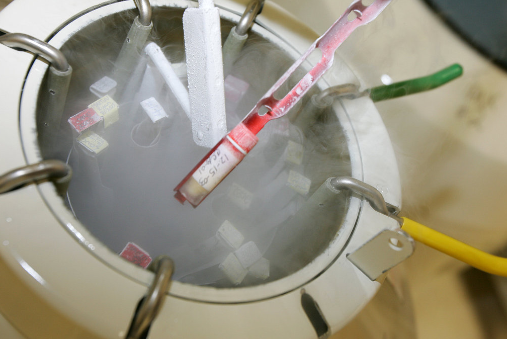 液氮罐溫控 液氮罐溫控